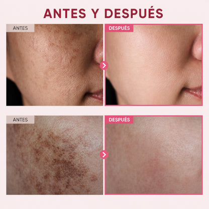 Crema Aclaradora Coreana