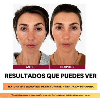 Crema Anti-edad Madeca